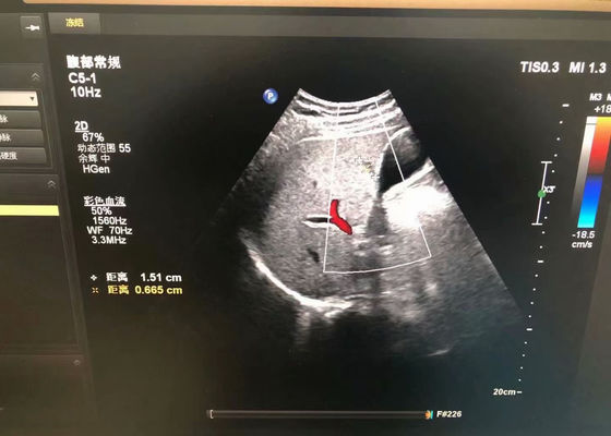 Philip C5-1 Abdominale medische echografie proef voor EPIQ 5 apparaat