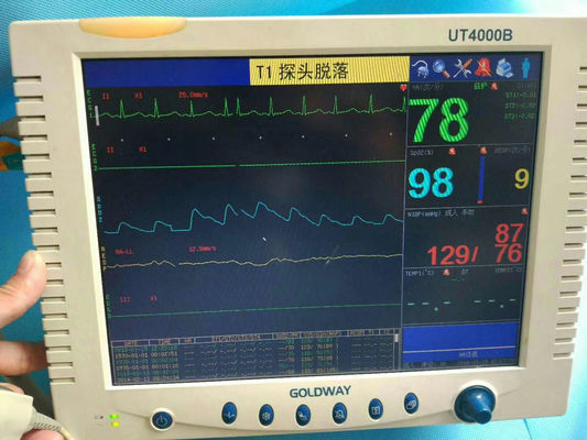Goldway UT4000B Patiëntmonitor Reparatie Medisch Patiëntmonitor Onderhoud